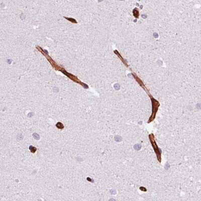 Immunohistochemistry-Paraffin: Vimentin Antibody (CL0157) [NBP2-52867]