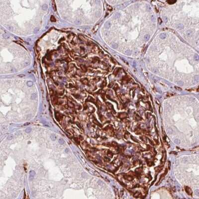 Immunohistochemistry-Paraffin: Vimentin Antibody (CL0157) [NBP2-52867]
