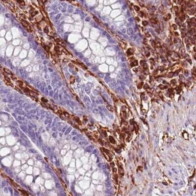 Immunohistochemistry-Paraffin: Vimentin Antibody (CL0157) [NBP2-52867]