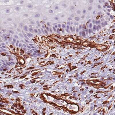 Immunohistochemistry-Paraffin: Vimentin Antibody (CL0157) [NBP2-52867]