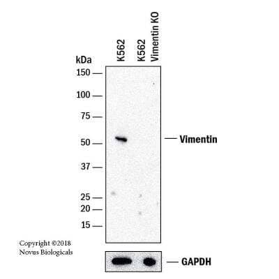 Knockout Validated: Vimentin Antibody (CL0157) [NBP2-52867]