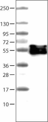 Western Blot: Vimentin Antibody (CL0157) [NBP2-52867]