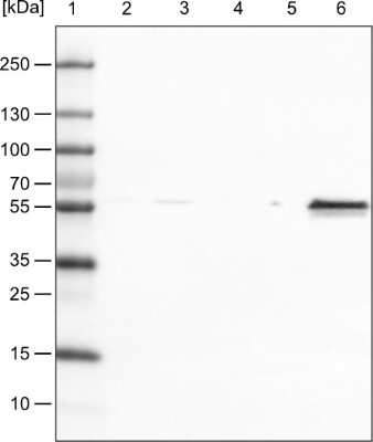 Western Blot: Vimentin Antibody (CL0157) [NBP2-52867]