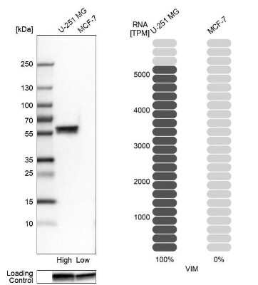 Western Blot: Vimentin Antibody (CL0157) [NBP2-52867]