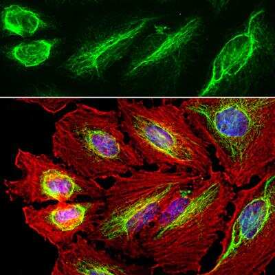 Immunocytochemistry/ Immunofluorescence: Vimentin Antibody [NB300-223]