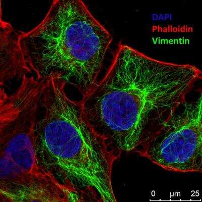 Immunocytochemistry/ Immunofluorescence: Vimentin Antibody [NB300-223]