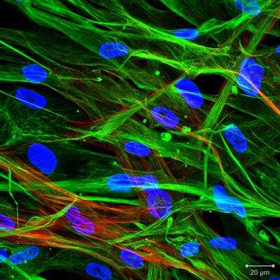 Immunocytochemistry/ Immunofluorescence: Vimentin Antibody [NBP1-31327]