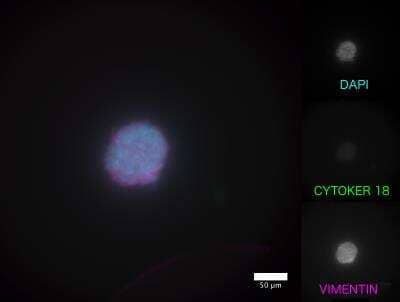 Immunocytochemistry/ Immunofluorescence: Vimentin Antibody [NBP1-31327]