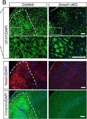 Immunohistochemistry: Vimentin Antibody [NB300-223]