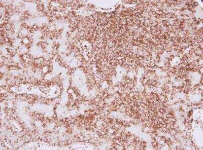 Immunohistochemistry-Paraffin: Vimentin Antibody [NBP1-31327]