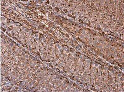 Immunohistochemistry-Paraffin: Vimentin Antibody [NBP1-31327]