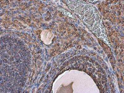 Immunohistochemistry-Paraffin: Vimentin Antibody [NBP1-31327]