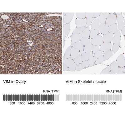Immunohistochemistry-Paraffin: Vimentin Antibody [NBP1-85814]