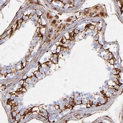 Immunohistochemistry-Paraffin: Vimentin Antibody [NBP1-85814]