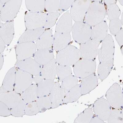 Immunohistochemistry-Paraffin: Vimentin Antibody [NBP1-85814]