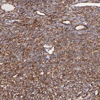 Immunohistochemistry-Paraffin: Vimentin Antibody [NBP1-85814]