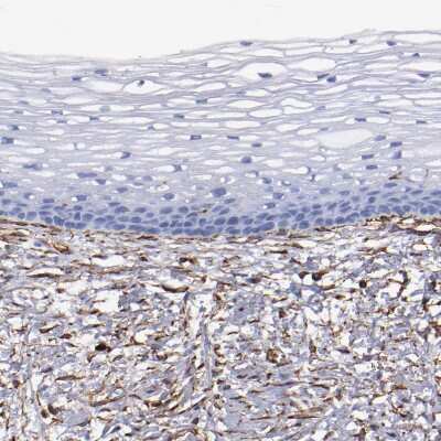 Immunohistochemistry-Paraffin: Vimentin Antibody [NBP1-85814]