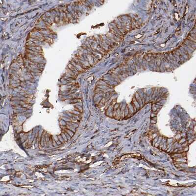 Immunohistochemistry-Paraffin: Vimentin Antibody [NBP1-85814]