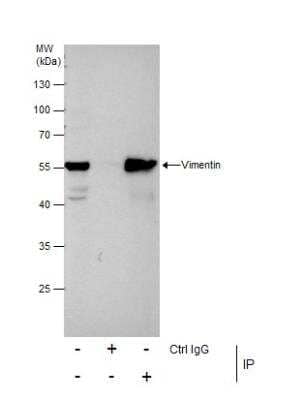Immunoprecipitation: Vimentin Antibody [NBP1-31327]