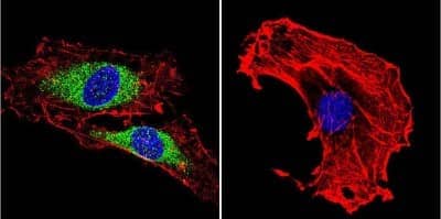 Immunocytochemistry/ Immunofluorescence: Vimentin Antibody (J144) [NB100-74564]