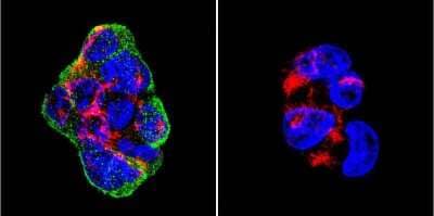 Immunocytochemistry/ Immunofluorescence: Vimentin Antibody (J144) [NB100-74564]