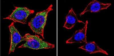 Immunocytochemistry/ Immunofluorescence: Vimentin Antibody (J144) [NB100-74564]