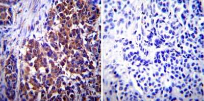 Immunohistochemistry-Paraffin: Vimentin Antibody (J144) [NB100-74564]