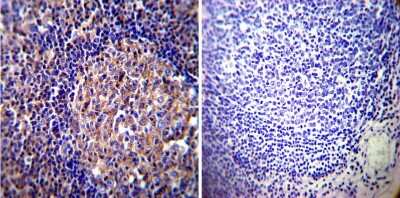 Immunohistochemistry-Paraffin: Vimentin Antibody (J144) [NB100-74564]