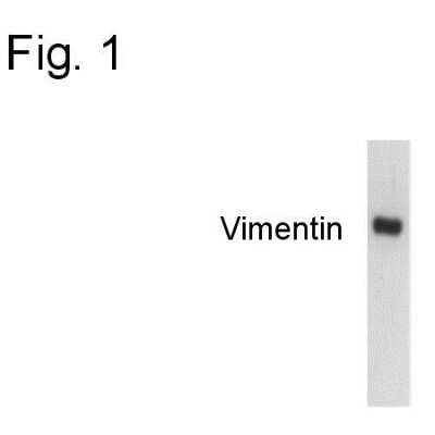 Western Blot: Vimentin Antibody (J144) [NB100-74564]