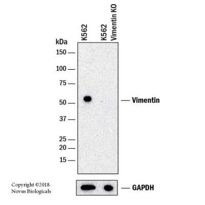 Knockout Validated: Vimentin Antibody [NBP1-85814]