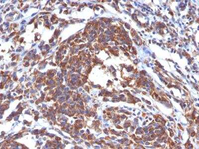 Immunohistochemistry-Paraffin: Vimentin Antibody (LN-6) - Azide and BSA Free [NBP2-47949]