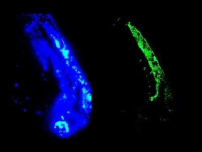 Immunocytochemistry/ Immunofluorescence: Vimentin Antibody (RV202) - BSA Free [NBP1-97672]