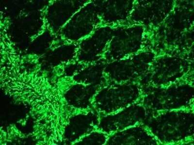 Immunohistochemistry-Frozen: Vimentin Antibody (RV202) - BSA Free [NBP1-97672]