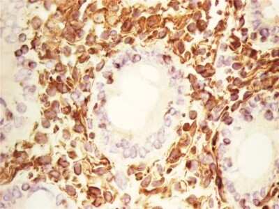 Immunohistochemistry-Frozen: Vimentin Antibody (RV202) - BSA Free [NBP1-97672]