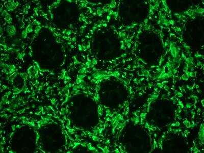 Immunohistochemistry-Frozen: Vimentin Antibody (RV202) - BSA Free [NBP1-97672]