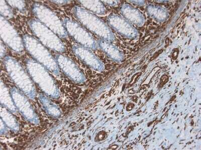Immunohistochemistry-Paraffin: Vimentin Antibody (RV202) - BSA Free [NBP1-97672]