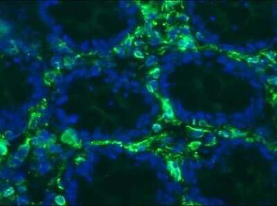 Immunohistochemistry-Frozen: Vimentin Antibody (RV203) - BSA Free [NBP1-97671]