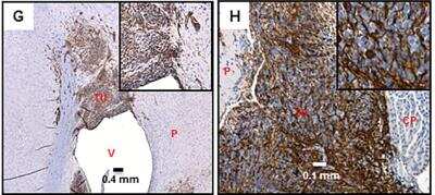 Immunohistochemistry: Vimentin Antibody (RV203) - BSA Free [NBP1-97671]