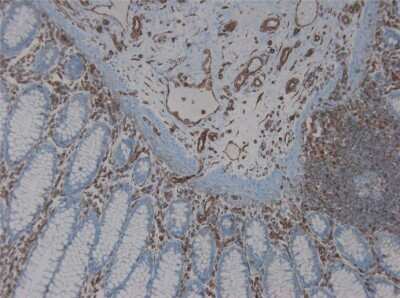Immunohistochemistry-Paraffin: Vimentin Antibody (RV203) - BSA Free [NBP1-97671]
