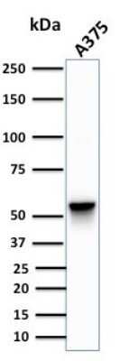 Western Blot: Vimentin Antibody (SPM576)Azide and BSA Free [NBP2-34809]