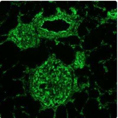 Immunocytochemistry/ Immunofluorescence: Vimentin Antibody (V9) - BSA Free [NBP1-97670]