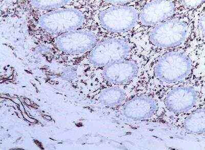 Immunohistochemistry-Frozen: Vimentin Antibody (V9) - BSA Free [NBP1-97670]