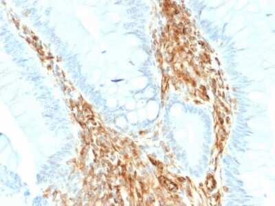 Immunohistochemistry-Paraffin: Vimentin Antibody (VIM/1937R) - Azide and BSA Free [NBP3-08936]