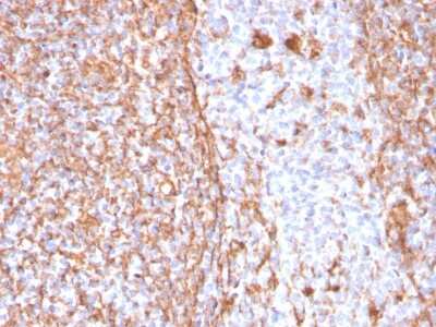 Immunohistochemistry-Paraffin: Vimentin Antibody (VIM/1937R) - Azide and BSA Free [NBP3-08936]