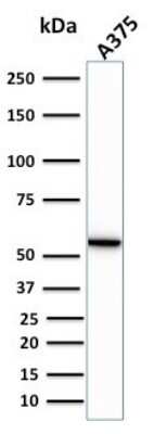 Western Blot: Vimentin Antibody (VIM/1937R)Azide and BSA Free [NBP3-08936]