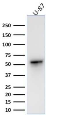 Western Blot: Vimentin Antibody (VIM/1937R)Azide and BSA Free [NBP3-08936]