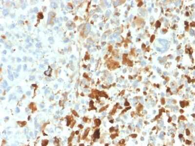 Immunohistochemistry-Paraffin: Vimentin Antibody (VIM/1937R) [NBP3-07191]