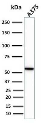 Western Blot: Vimentin Antibody (VIM/1937R) [NBP3-07191]
