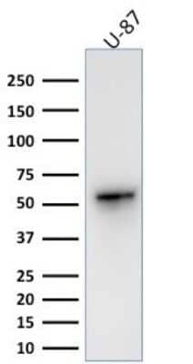 Western Blot: Vimentin Antibody (VIM/1937R) [NBP3-07191]