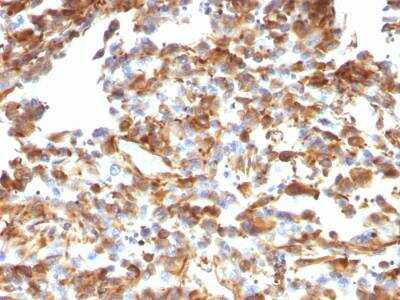 Immunohistochemistry-Paraffin: Vimentin Antibody (VM1170) - Azide and BSA Free [NBP2-47950]